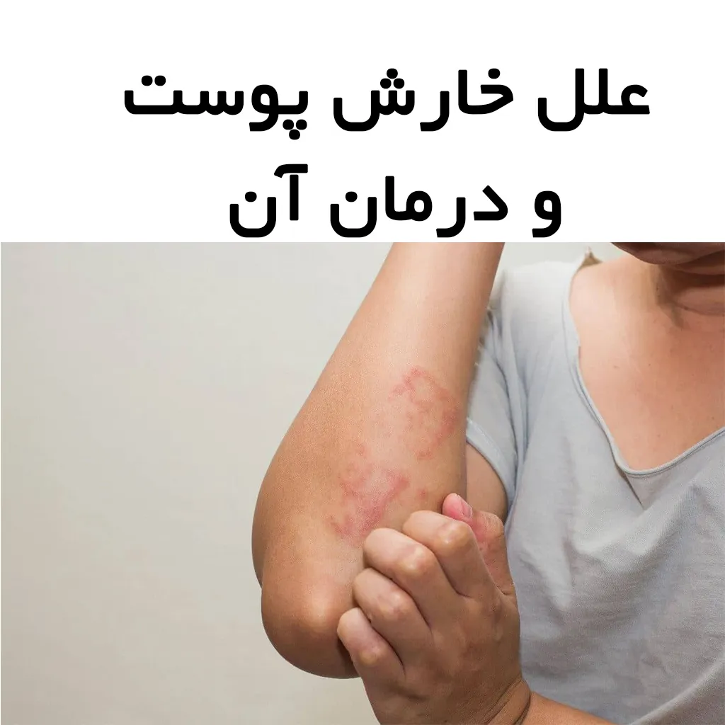علت های خارش پوست