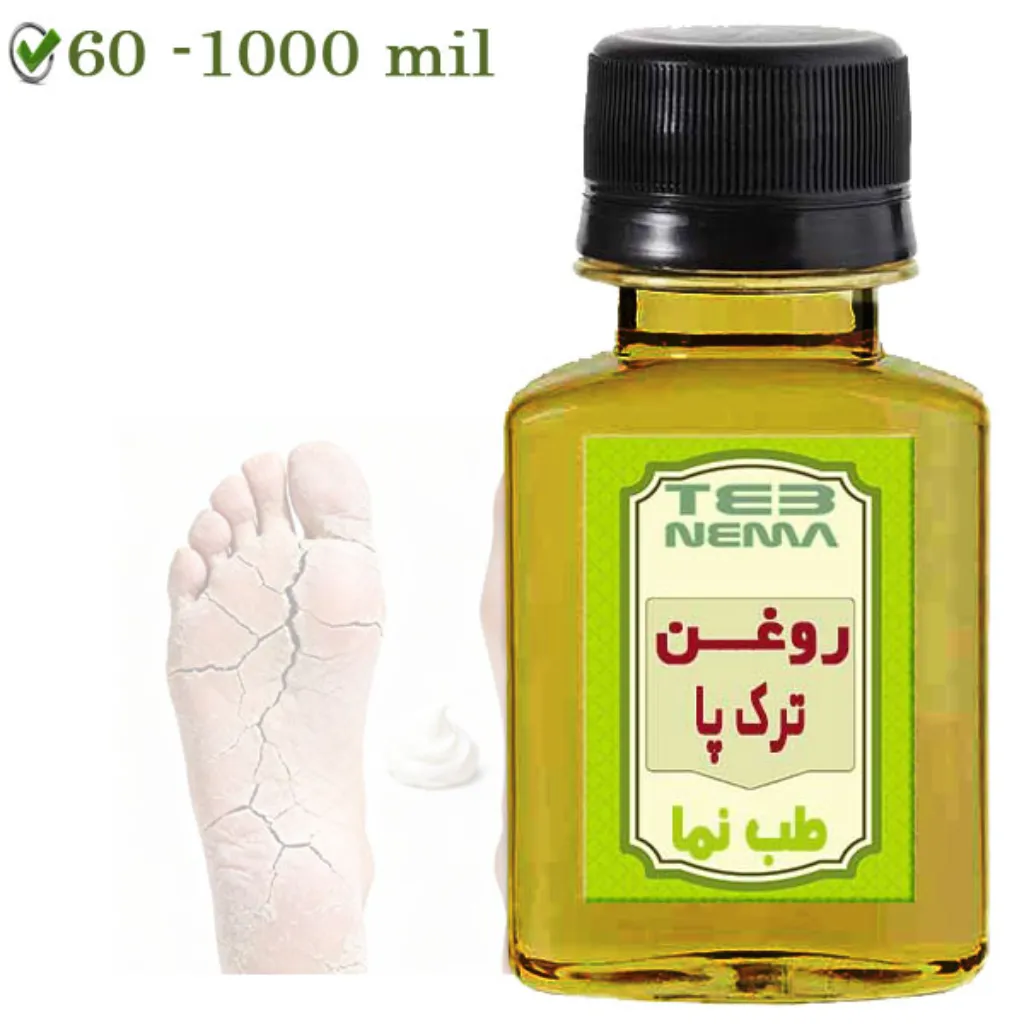 روغن ترک دست و پا (پیشگیری و درمان)